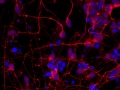 Axonal web by Anthony Flamier