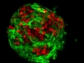 Reprogramming of Lung Epithelial Cells 1 by Lily Guo
