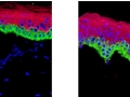 Separating dermal component of skin from epidermal part by Saeid Amini Nik and Shermineh Minaie