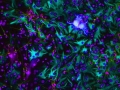 THIS IS YOUR BRAIN ON STEM CELLS by Samantha Yammine