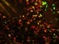 Van Gogh's Immune Invasion by Waleed Rahmani