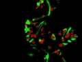 "When Neural Stem Cells "Swan" around" by Radhika Rao