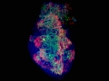 Bio-artificial Pancreas Underneath the Skin