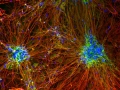 From Bladder to Brain: Cortical Neurons from Urine-Derived Stem Cells