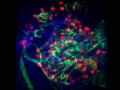 Revascularized Pseudo-islet