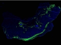 Stem Cells in Hydrogels to Mend Broken Hearts