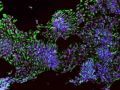 The Brain Stem Cells