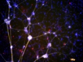 The Pancreatic Art(net)work