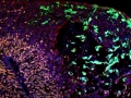 Cells from Outer Space Aliens Invading the Planet Brain