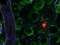 Being-a-mesenchymal-stem-cell-in-the-adipose-bubble-world