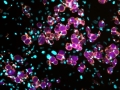 Bubbles, bubbles everywhere. Be as bubbly as your fat cells.