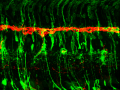 The thin red line between retinal stem cells bottom and differentia