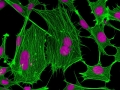 07-Stem-cell-web_Iram-Fatima-Siddiqui