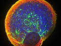 11-Chaineau_NeuronalStormShell
