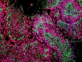15-Sandeep-human-neuroepithelium-2D