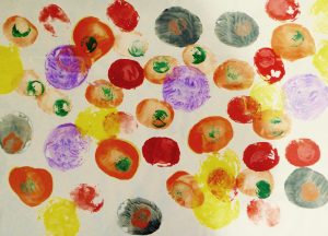 "My Uncle's Stem Cells" by Jack Wylie