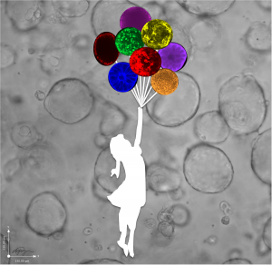 "Reaching for Organoids" by Amy Wong