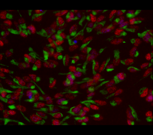 "Neural Strawberries: An Embryonic Stem Cell Origin" by Sakthi Moorthy